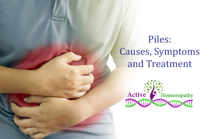Homeopathic Treatment for Piles : Active Homoeopathy